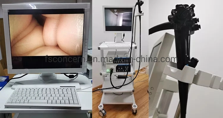 Medical Hospital Hot Sale HD Operation Video Endoscopy Tower Digital Video Gastroscope Colonoscope Endoscope